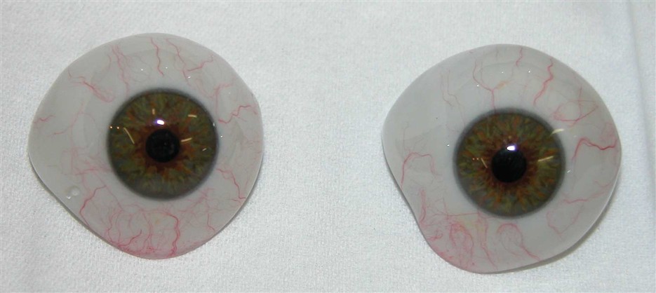 prothèses oculaires identiques