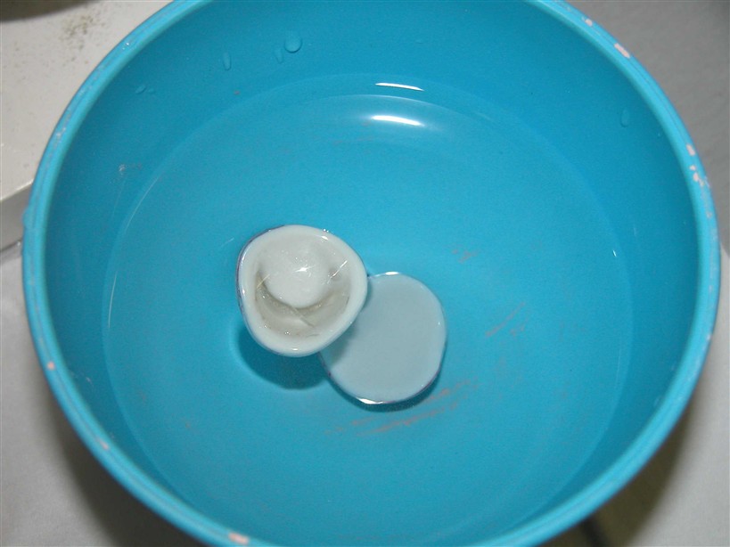 Prothèse oculaire flottante