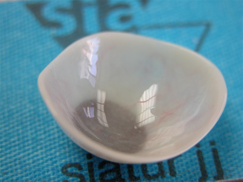 prothèse oculaire fine intrado