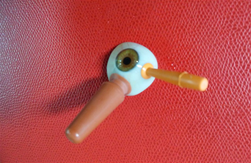 2 ventouses sur prothèse oculaire